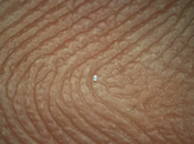   008004 capacitor on finger  