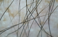 &nbsp;&nbsp;hairy arm&nbsp;&nbsp;